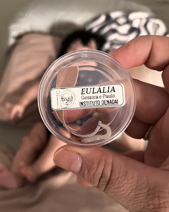 O modelador nasal da Eulália, no estojo do Instituto Denadai.
