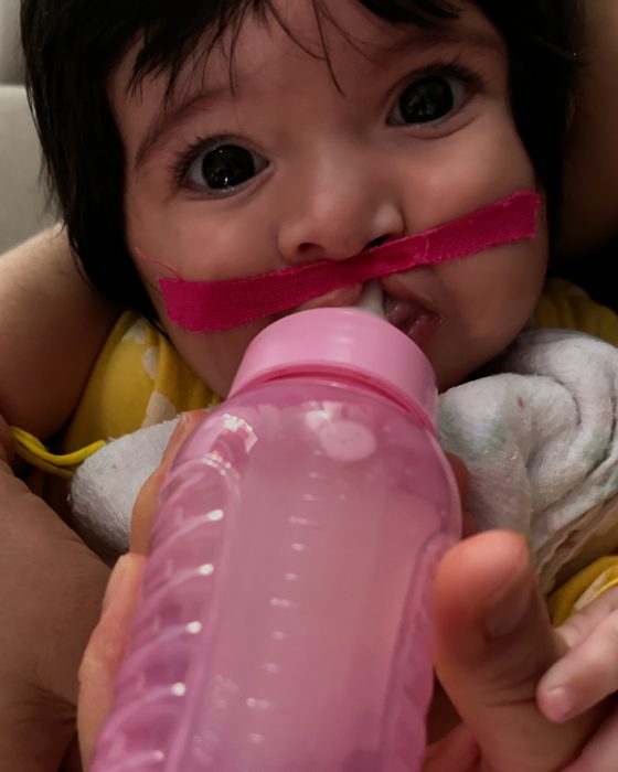 Preparação para a cirurgia